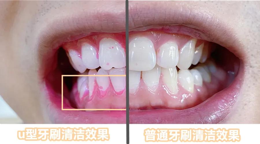 最近风很大的儿童U型牙刷，我劝你直接退出母婴产品界吧