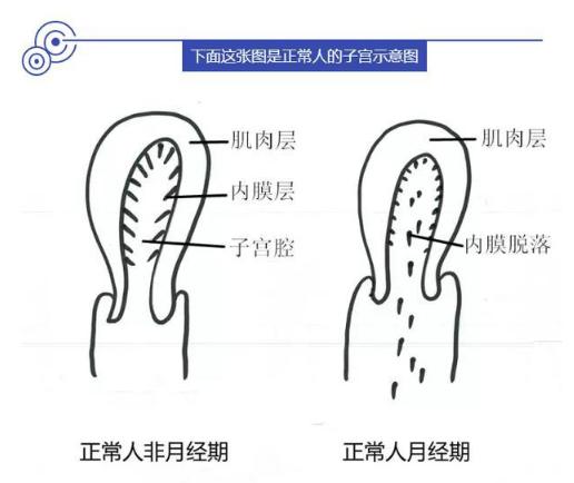 子宫腺肌症怎么治疗最好,子宫腺肌症中医的最新治疗