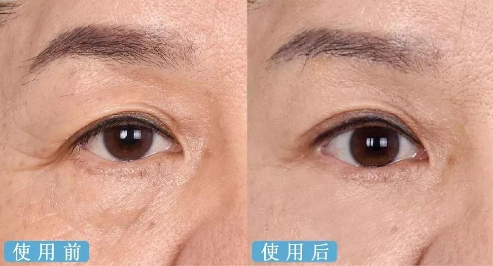 雅诗兰黛日本产的眼霜,用了雅诗兰黛皱纹更明显了