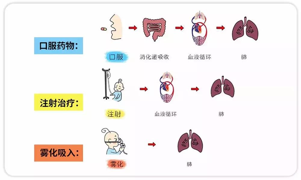 听说雾化治疗危害大？是真是假，看完你就懂