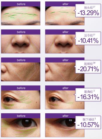 olay小白瓶出新款了吗,olay热销抗老爆款