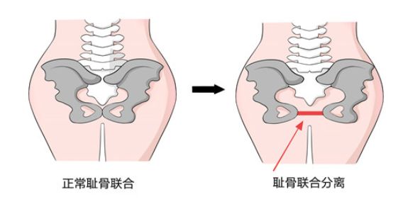 孕晚期心里难受怎么办,孕晚期腰疼痛难忍没人理解