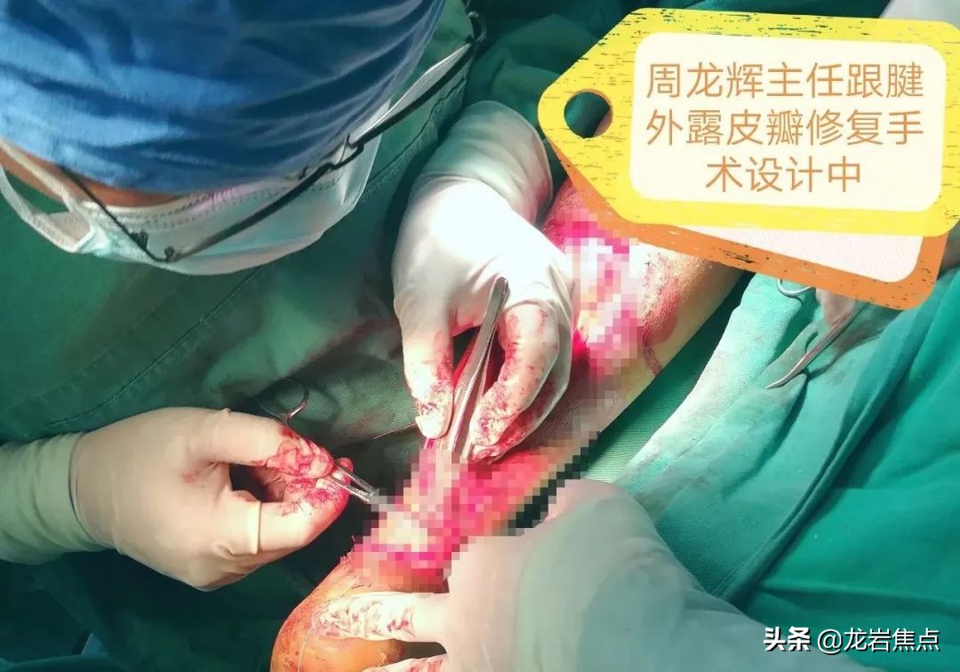 整块皮没了怎么处理,整块皮肤没了会增生吗