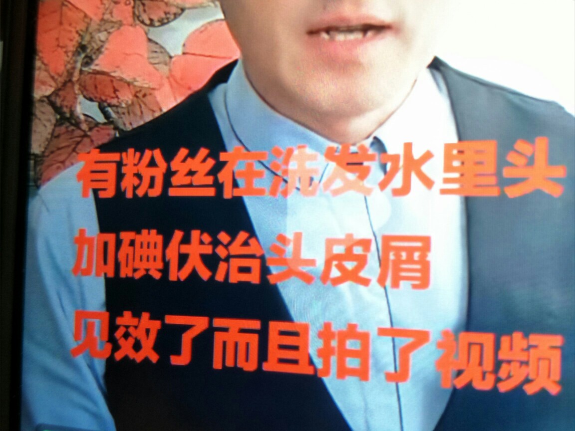 去头皮屑就这么简单，这一招我服，非常感谢鹤叔的推荐！