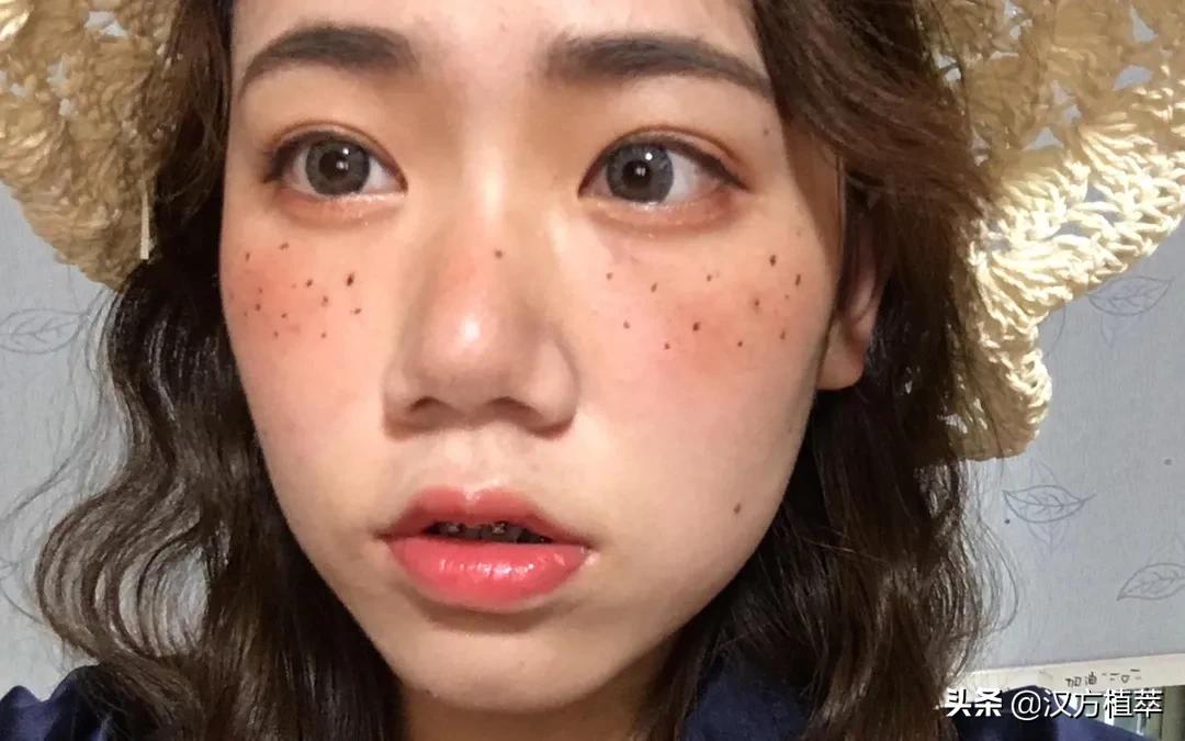 做斑一年了皮肤有点红,做斑后会变得很老吗