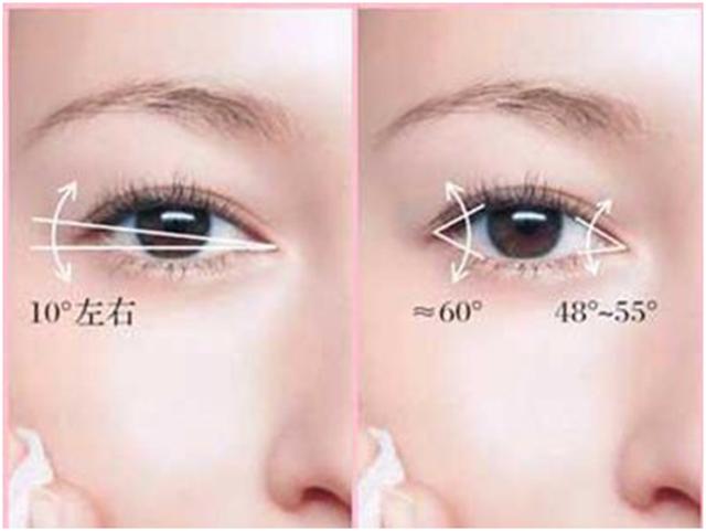 开了眼角会变回原来吗,开过的外眼角会长起来吗