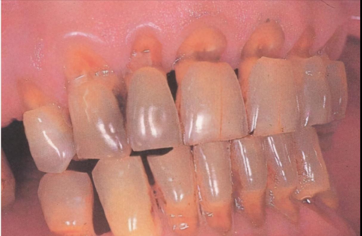 意大利银卫士牙刷,口腔清道夫电动牙刷