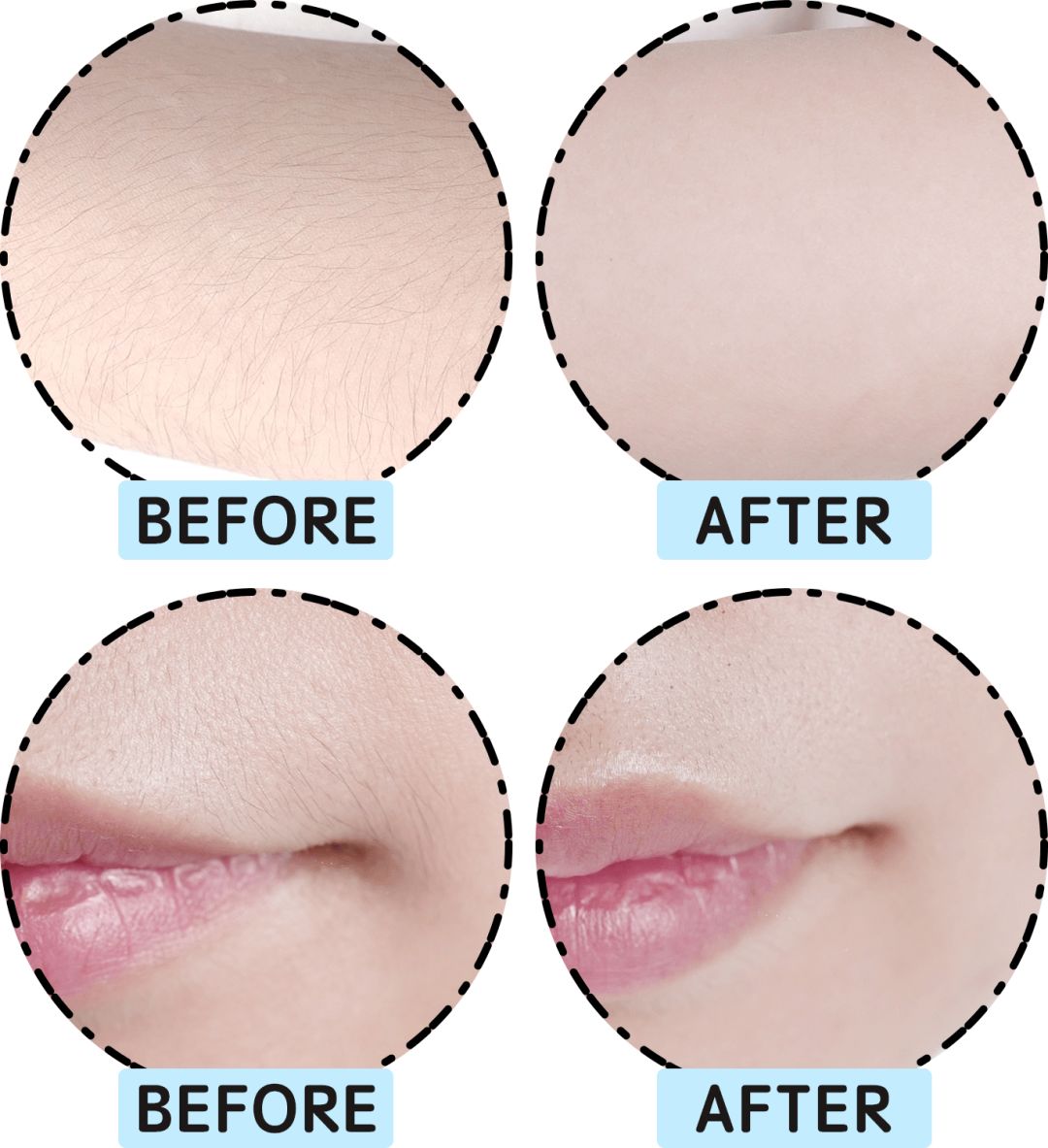 网红脱毛仪器家用评测,网红脱毛仪哪个好用又便宜