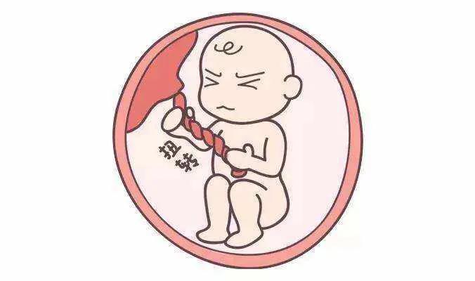 脐带绕颈一圈正常吗,孕期脐带绕颈是怎么回事