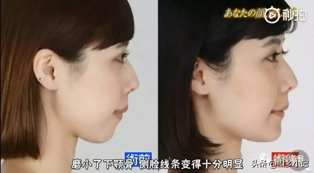 明明是整容脸现在却成了颜值巅峰,明明是整容脸却没被吐槽过