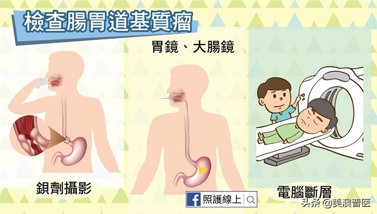 间质瘤导致消化道出血,肠道肿瘤导致出血