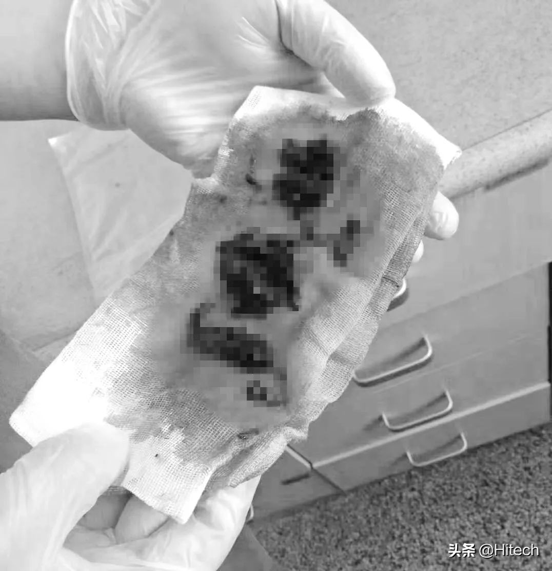 惊心动魄的救援行动,惊心动魄救援行动