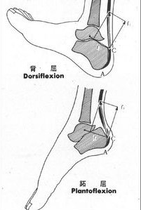 膝反屈的治疗方法,膝反屈是什么意思