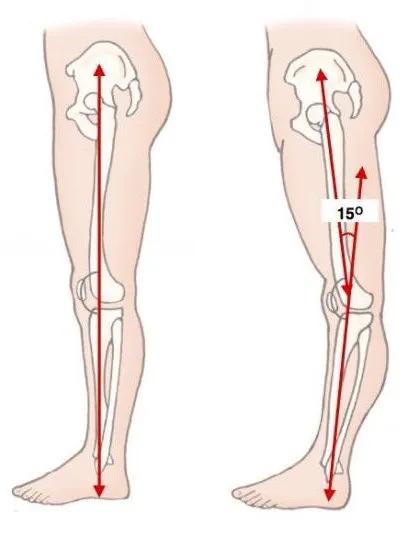 有效改善体态,提升气质减肥瘦全身方法