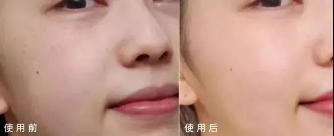 东星祛斑霜为什么火了,东星祛斑霜是真的吗