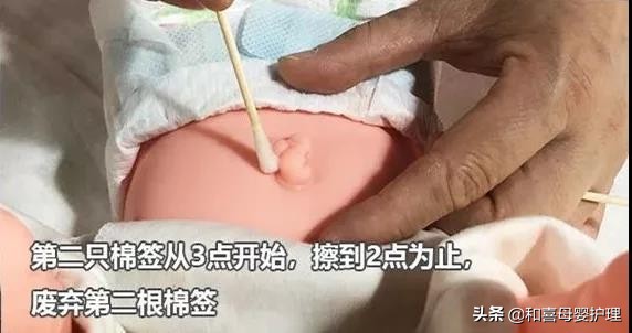 新生儿脐带一个月还没掉正常吗,新生儿脐带一个月没掉正常吗