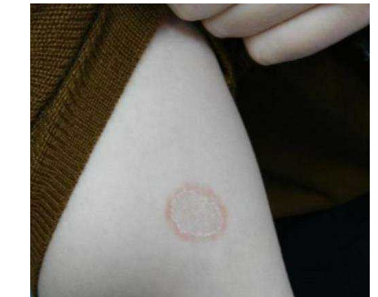 不出门的健康猫会感染猫瘟吗,完全不出门的猫会生病吗