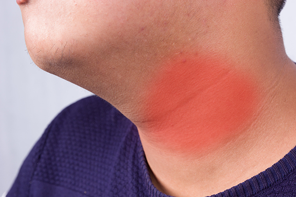 甲状腺结节4a级饮食需要注意什么,甲状腺结节有什么症状不能吃什么