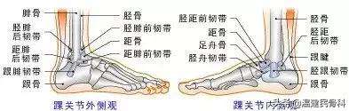 走路走多了，没锻炼到身体，却走出了刘翔的足球踝？看专家怎么说