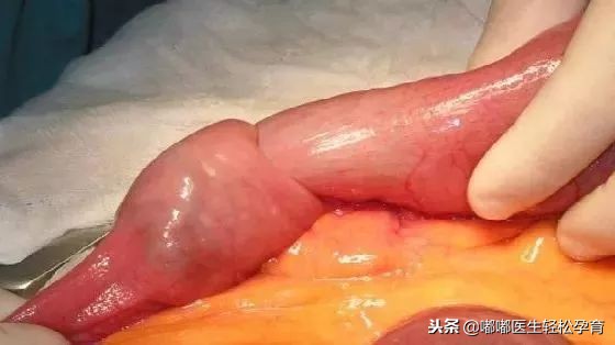 宝宝肚子疼一揉就有水声,宝宝肚子疼一下就没事了怎么回事