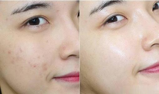 老牌国货肤美灵,被遗忘的护肤品牌