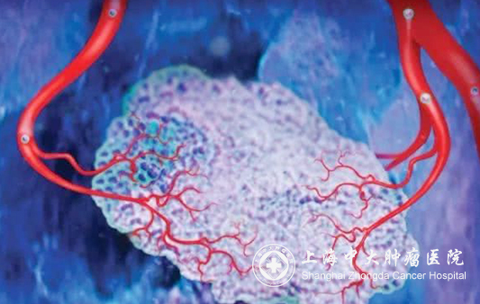 为什么癌症越治疗耐药越频繁,癌症耐药如何解决