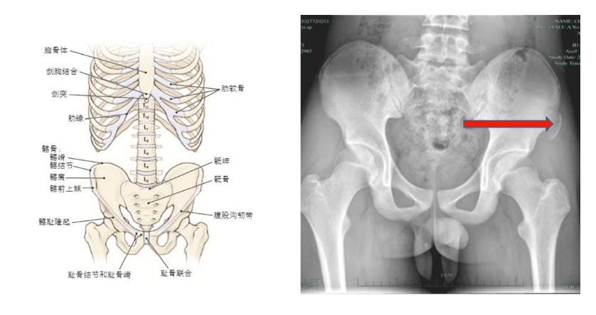 初中生800米冲刺没摔没撞竟骨折,广东初中体考800米满分