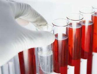 病人休克了,病人突然休克