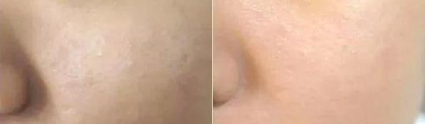 定妆粉排名第一名推荐真实测评,最近热门大牌的定妆粉