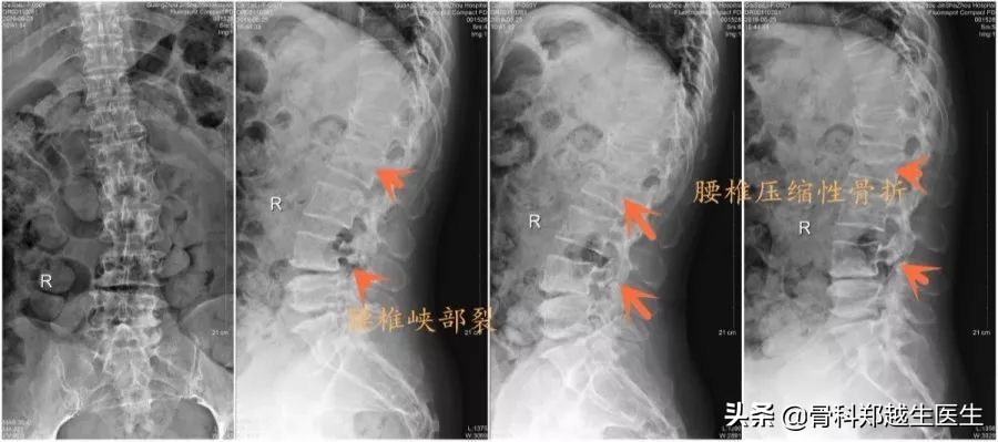 腰椎、颈椎疼痛，能不能推拿按摩治疗？骨科医生提出了这样的意见