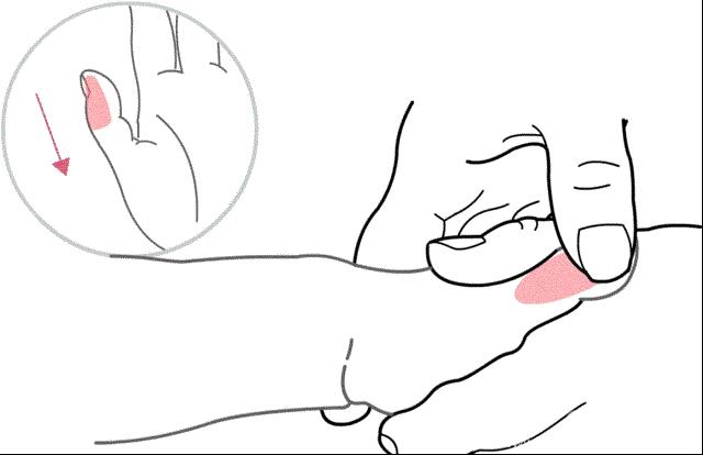 冬天儿童上火的方法,冬天儿童上火了怎样降火最快