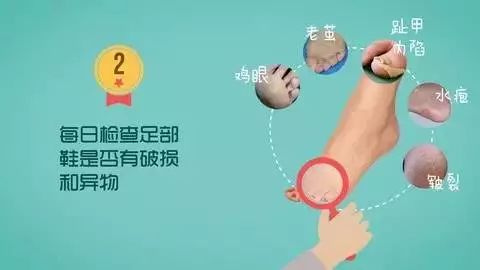 糖尿病怎么运动血糖好还更安全？跑步机适合糖友吗？