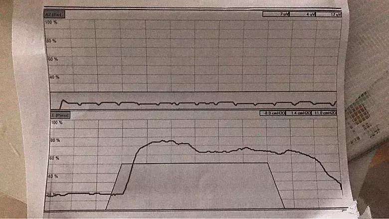 ella自曝产后后遗症,ella自曝产后尿失禁