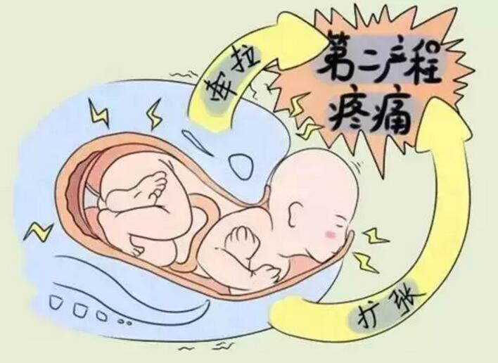 顺产和剖腹产哪个疼得轻,顺产与剖腹产的利弊孕妈选哪种