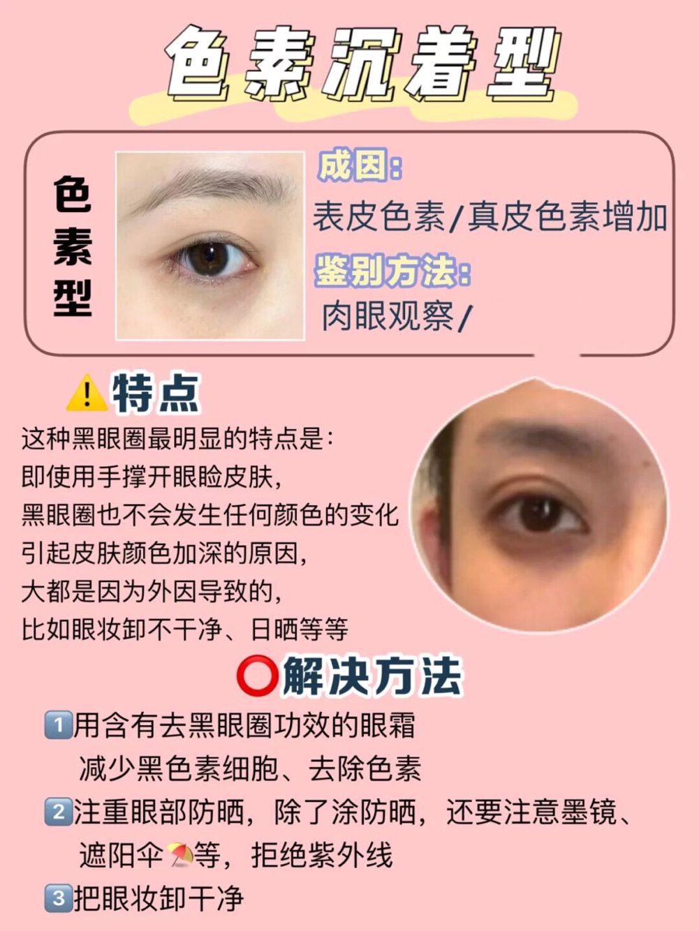 去色素型黑眼圈最有效的方法,去除色素黑眼圈有效方法