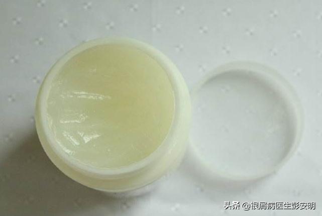 凡士林加西瓜能治好银屑病吗,银屑病西瓜霜和凡士林