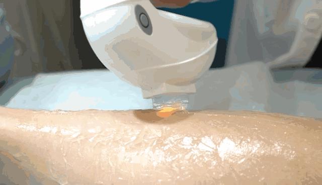 plmm脱毛产品,plmm测评