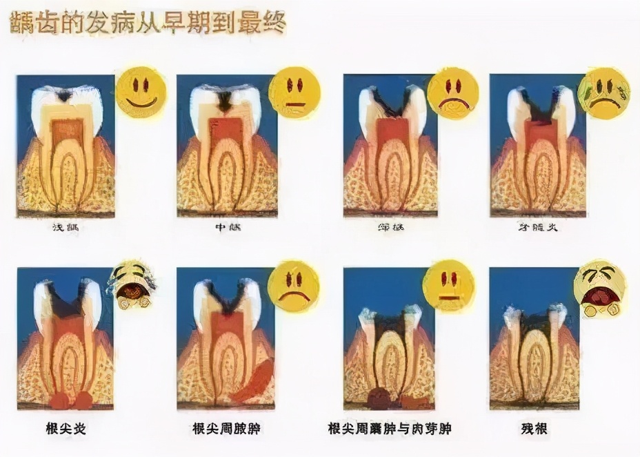 洗牙会不会使牙缝变大呢,洗牙会使牙齿松动牙缝变大吗
