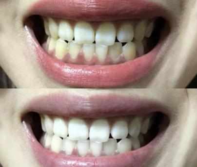 去除牙渍最好的牙膏,去牙渍亮白口气清新最好用的牙膏