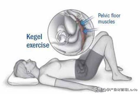 产后一年了出现漏尿问题怎么解决,产后漏尿正确凯格尔运动视频教程