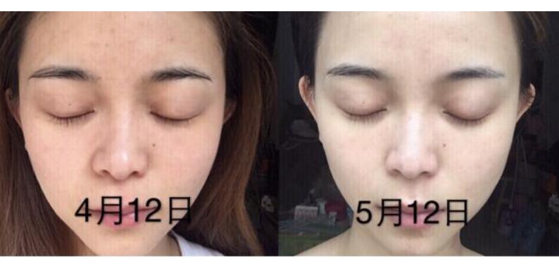 国宝级美容仪李佳琦,李佳琦讲美容仪