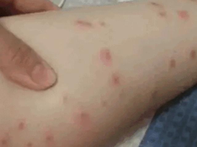 驱蚊必备蚊香防蚊神器,防蚊必备电热蚊香驱蚊神器