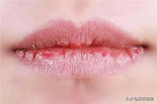 润唇膏红黑榜十几块钱,润唇膏有没有必要买大牌的