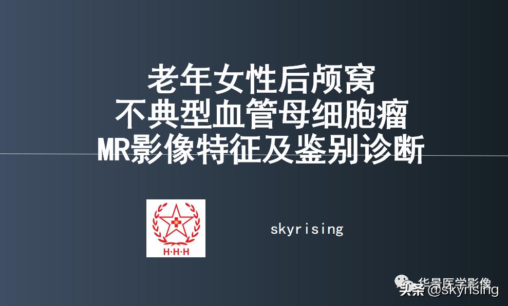椎体侵袭性血管瘤mri影像学表现,中年妇女脑部血管海绵体瘤的症状