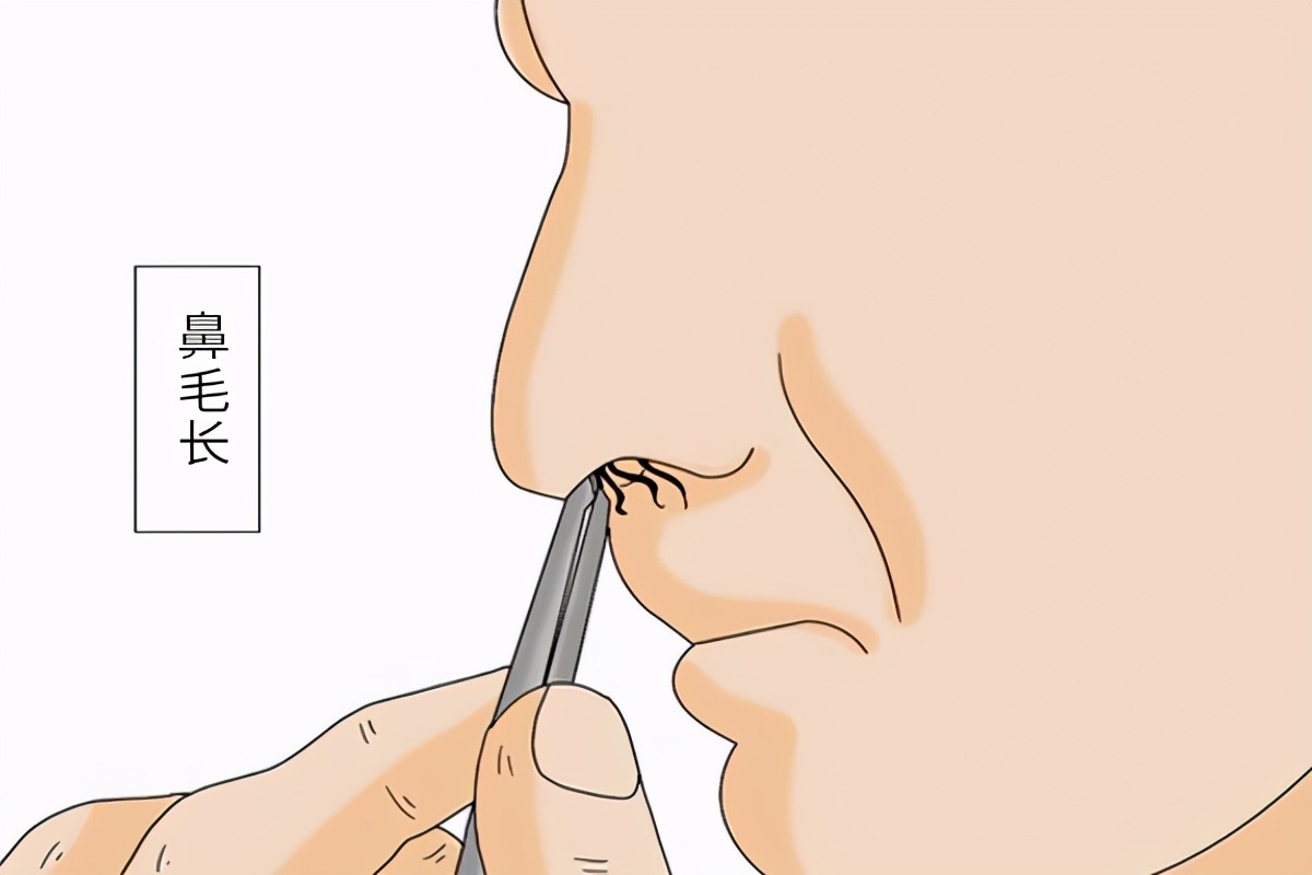 窜出来的鼻毛能剪吗,不小心把鼻毛揪下来会怎么样