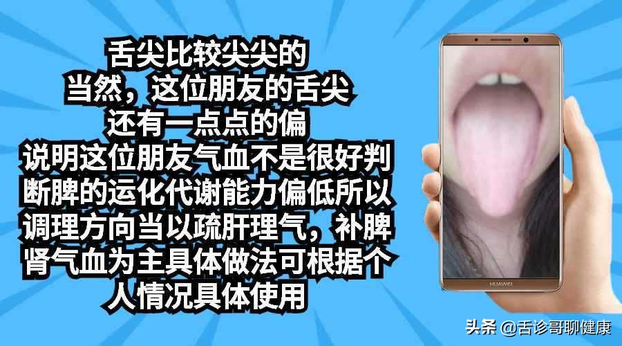 抖音舌诊哥,舌诊哥视频