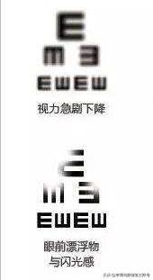 亨得利眼镜无框,亨得利眼镜可以免费换镜片吗
