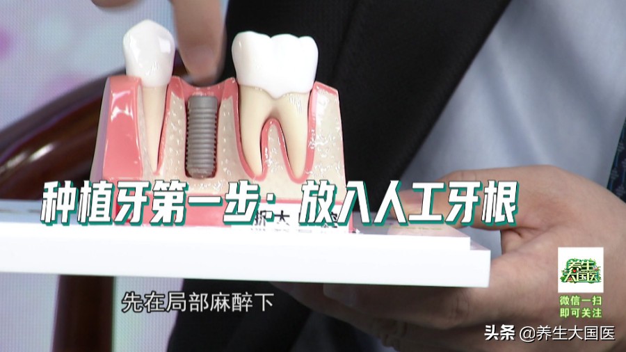 牙齿不整齐怎么修复,牙齿楔状缺损用树脂250好还是350好