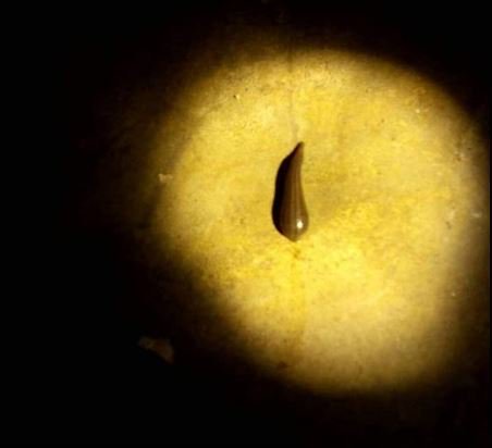 多大的水蛭会钻入人体,小水蛭钻入身体怎么办