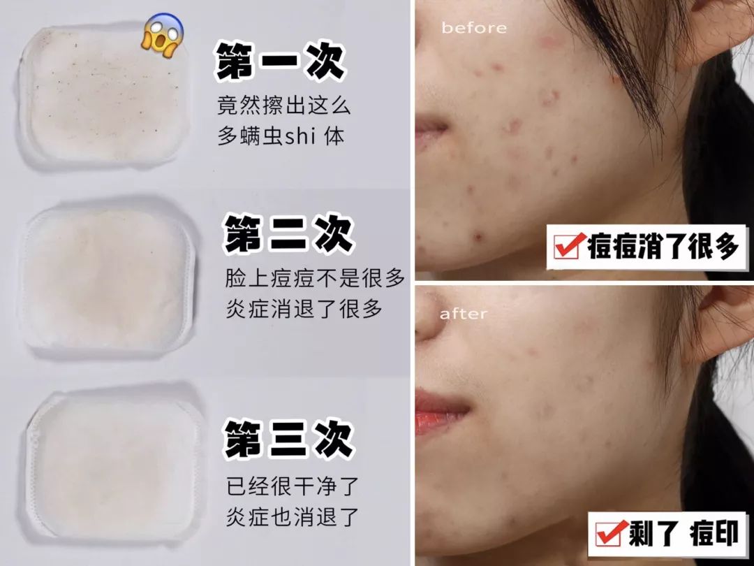 李小冉皮肤嫩白,李小冉肌肤白到发光